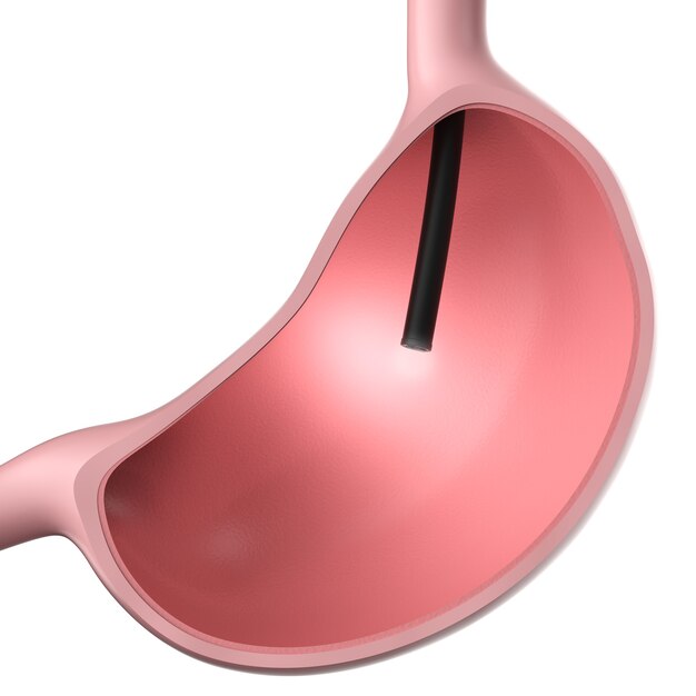 3D-rendering endoscoop in maag geïsoleerd op wit