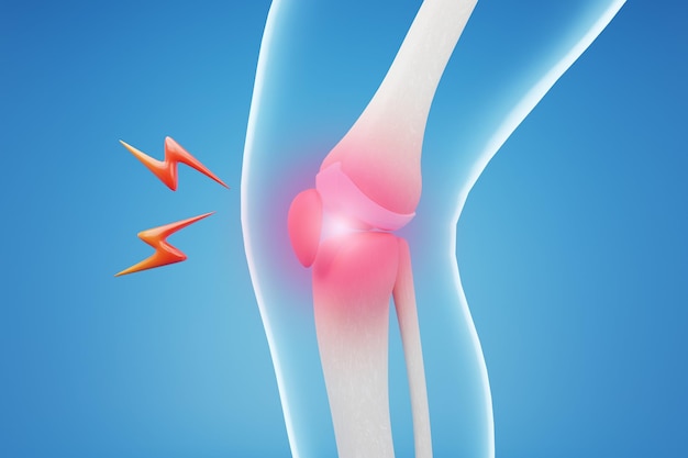 Photo 3d rendering of knee injury