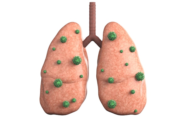 3d rendering lung disease with bacteria cells