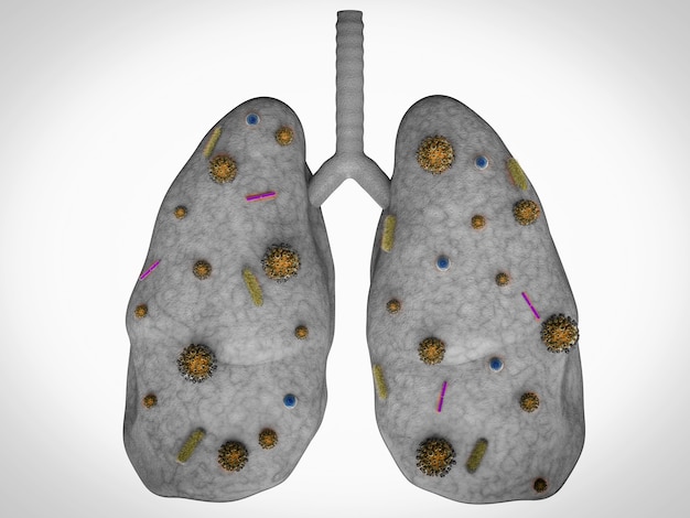 3d rendering lung disease with bacteria cells