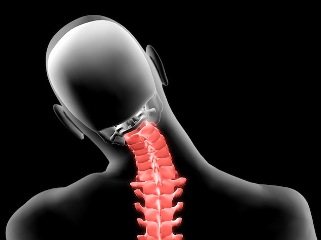 3d X-ray of painful neck