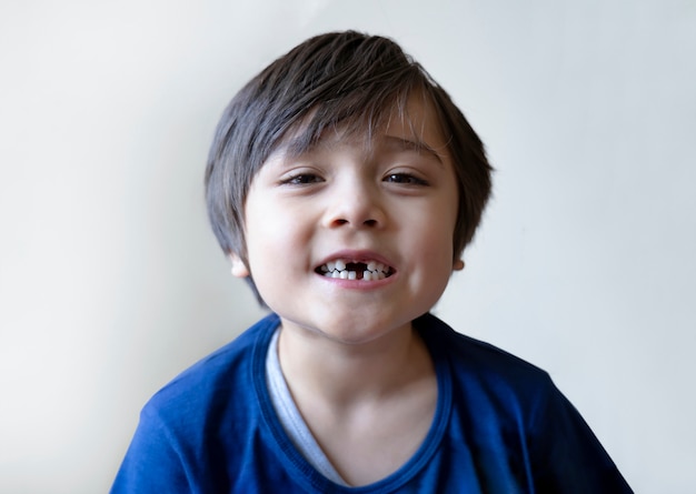 6-7 jaar oude jongen glimlacht en toont zijn ontbrekende tanden. Schattige kind verloor eerste melktand.