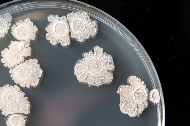 사진 과학 및 연구 시설 내부의 검은 배경에 대해 격리된 한천 접시에 식민지화된 박테리아 배양의 근접 촬영 및 상위 뷰