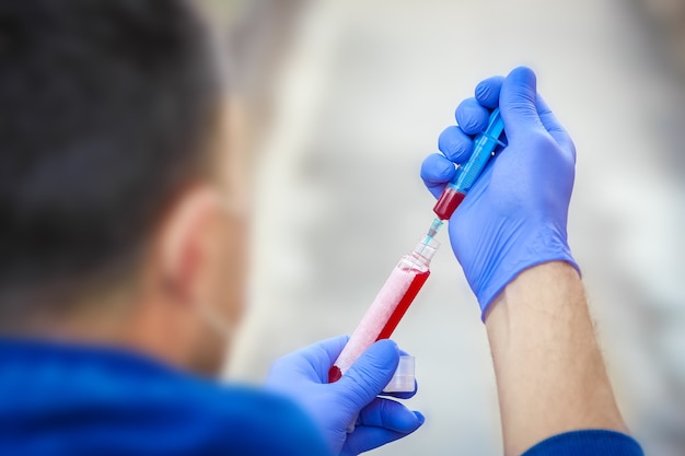 사진 남성의 손에 코로나 바이러스 혈액 검사 2019-2020. 크라운 바이러스 발생. 유행성 바이러스 호흡기 증후군. 중국