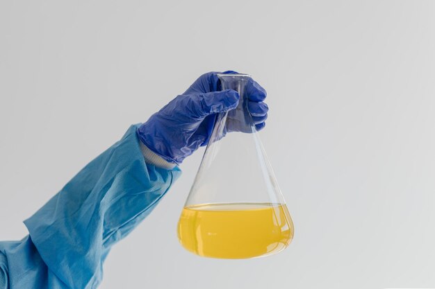 写真 青い防護服を着た人が、黄色い液体の入った試験管を持っています。