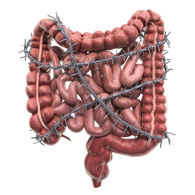 Abdominal pain concept Human intestines with barbed wire 3D rendering