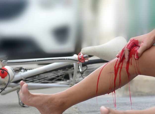 Foto l'incidente di una bicicletta è entrato in collisione con un'auto