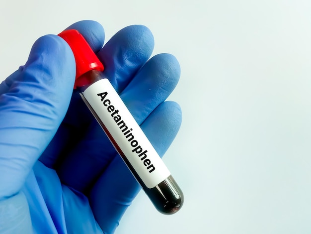 Photo acetaminophen or paracetamol test for the diagnosis of acetaminophen toxicity