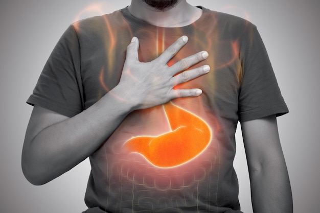 Photo acid reflux or heartburn