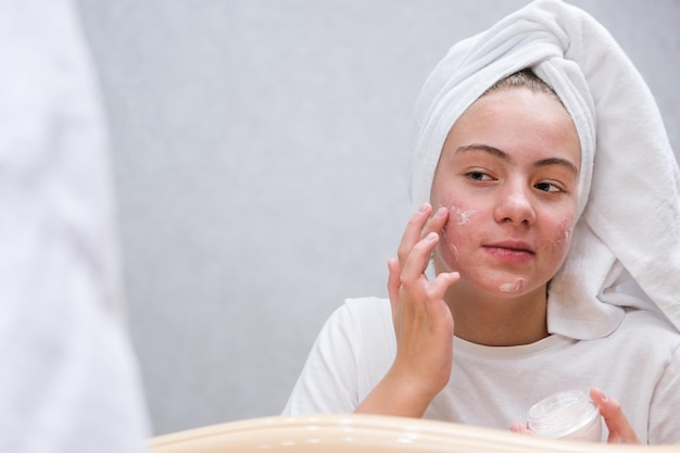 Acne una ragazza adolescente che applica una crema terapeutica sulla pelle problematica del suo viso trattamento dell'acne