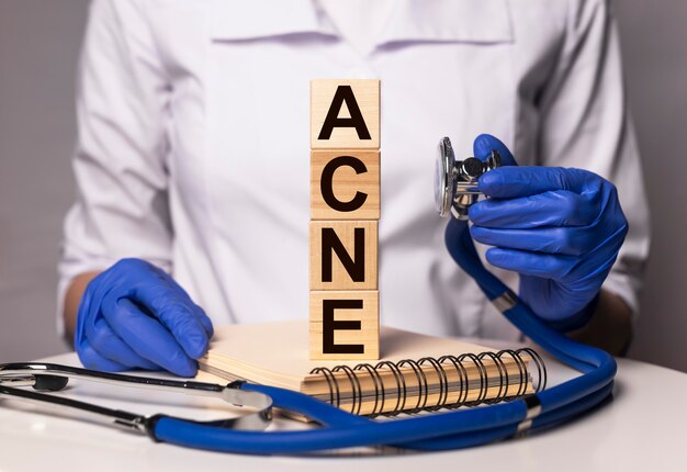 Acne word inscription on paper in doctor hands