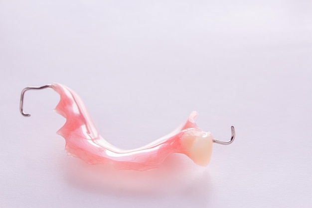 Acrylic denture with metal clasps for restoring dentition