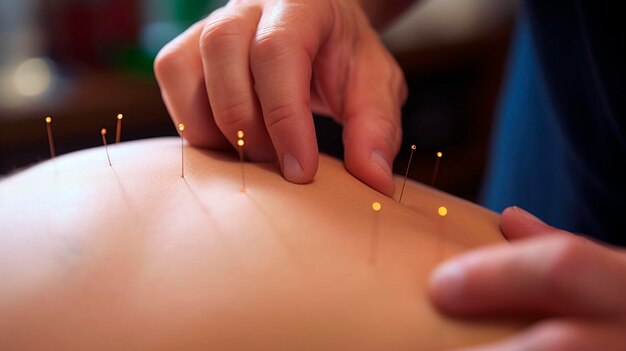 Photo acupuncture back neck spa salon generative ai people