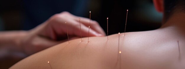 Photo acupuncture back neck spa salon generative ai people