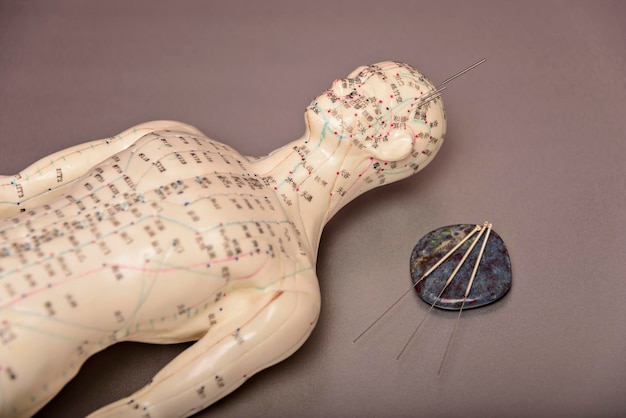 Photo acupuncture model with needles in the head