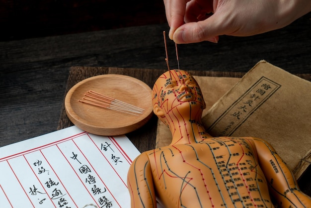 Acupuncture models and medical books are on the table. Acupuncture is a traditional Chinese medical method