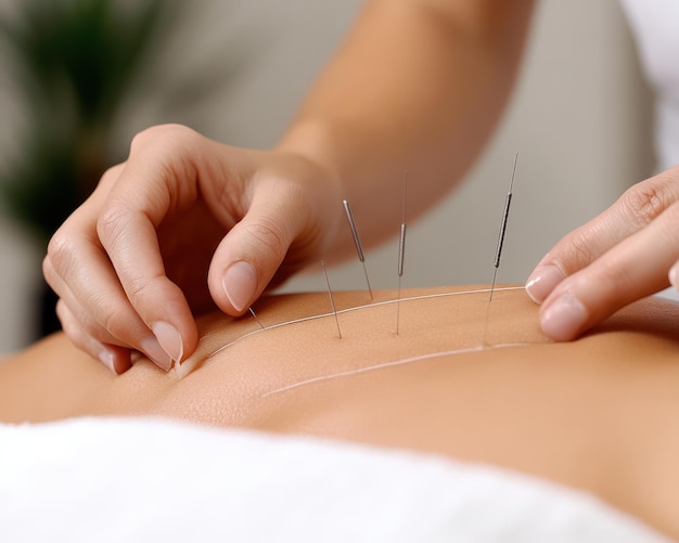 Photo acupuncture needles precision skill in hands traditional chinese medicine practitioner practicing