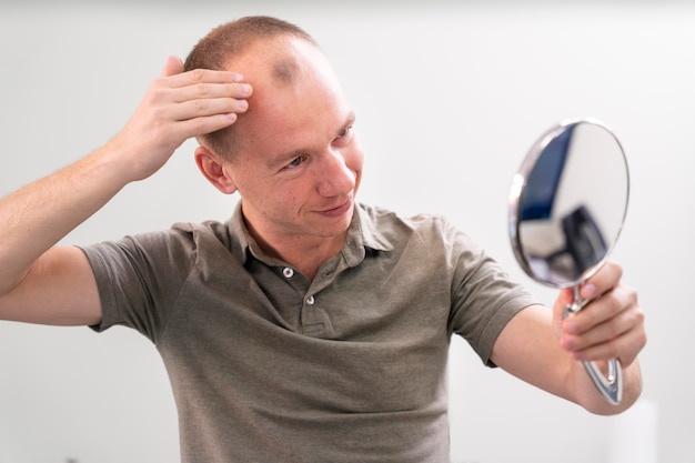 Photo adult male having balding problems