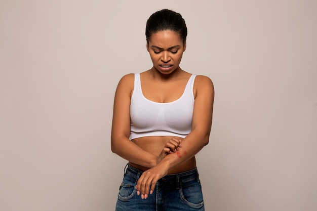 African american woman scratching red spots on her arm