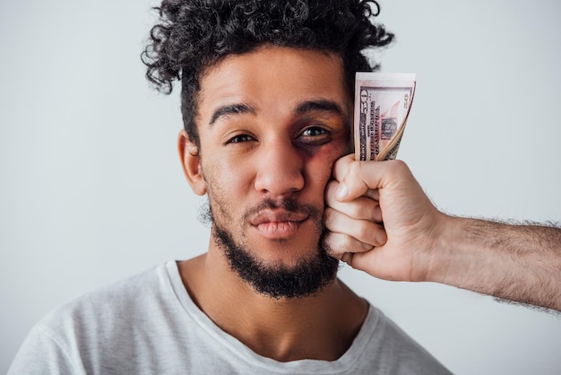 Afro-Amerikaanse man met blauwe plek kijken camera in de buurt van mannenhand met contant geld geïsoleerd op grijs