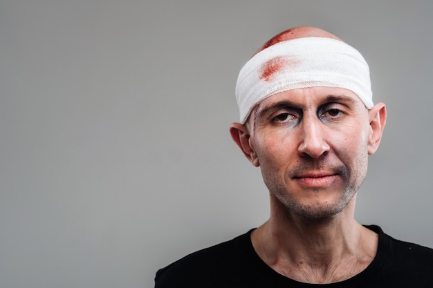 Against a gray wall, a battered and battered man in a black T-shirt with his head wrapped in a bandage