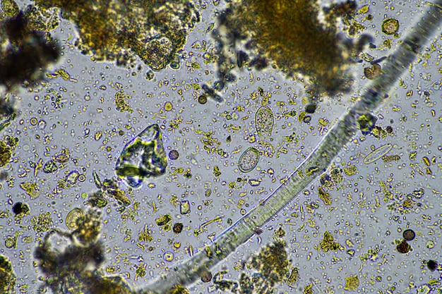 土壌生物と昆虫を含む土壌サンプルを持つ農学者 農場からの菌類やバクテリアで炭素を蓄える微生物