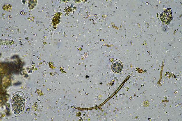 agronomist with a soil sample with soil life and bugs microorganisms storing carbon with fungi and bacteria from a farm