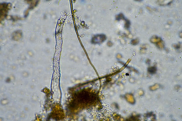 agronoom met een bodemmonster met bodemleven en insecten micro-organismen die koolstof opslaan met schimmels en bacteriën van een boerderij