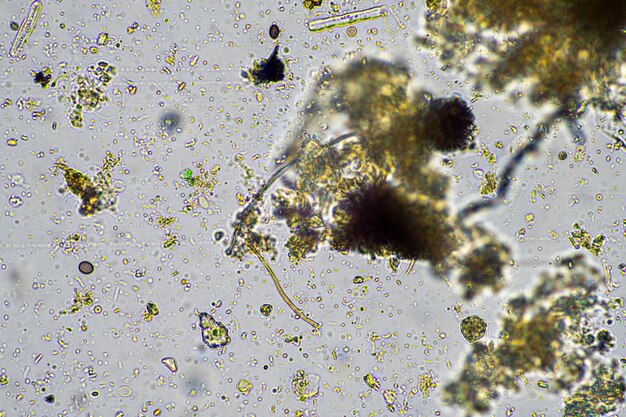 agronoom met een bodemmonster met bodemleven en insecten micro-organismen die koolstof opslaan met schimmels en bacteriën van een boerderij