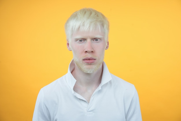 Albinism albino man in studio dressed t-shirt isolated on a yellow background. abnormal deviations. unusual appearance