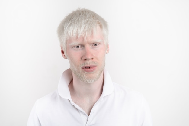 Photo albinism albino man