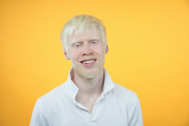 Albinism albino man