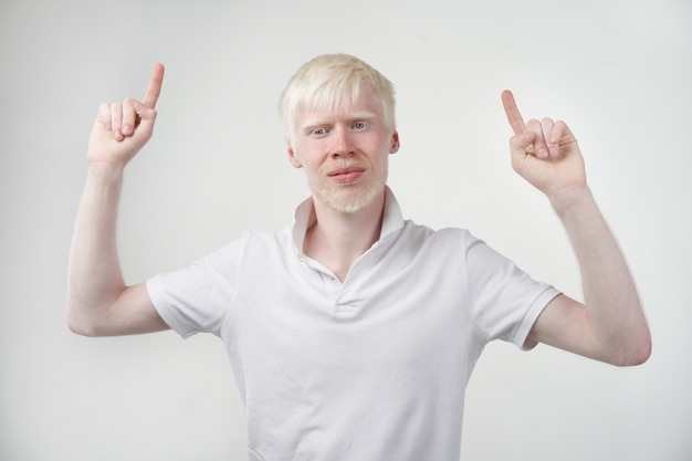 Albinisme albino man