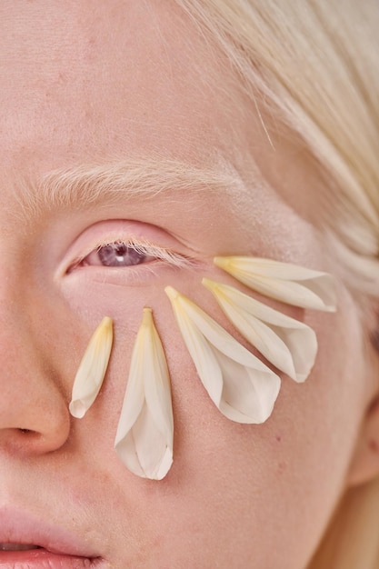 Albino girl with clean face skin