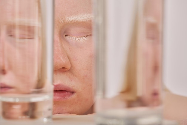 Photo albino girl with glasses of pure water