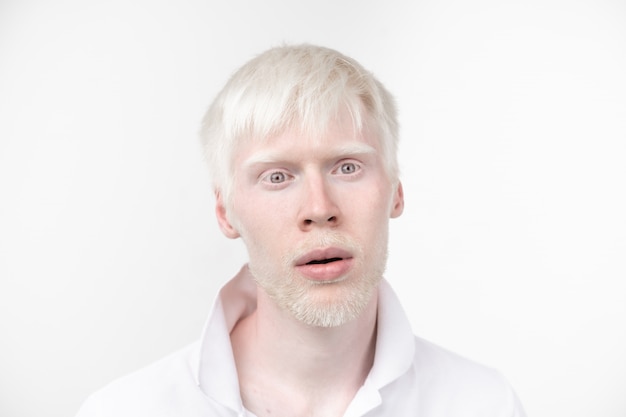 Uomo albino in t-shirt vestita in studio isolato su un bianco