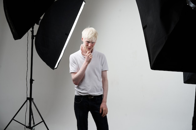 albino man in a studio with professional lights