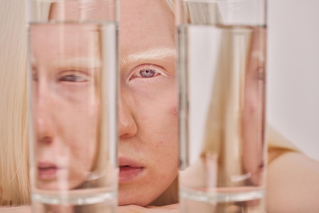 Albino meisje poseren met glazen water
