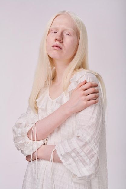 Albino-model poseren voor de camera