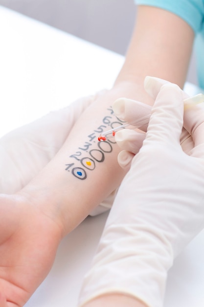 Allergen test on hand. child undergoing procedure of allergen skin test in clinic.