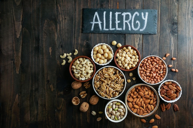 Allergy concept Nuts variety in the bowls cashew hazelnut macadamia pistachio almond walnut peanut pecan