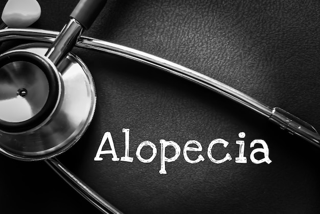 Слово алопеция, медицинский термин с медицинскими понятиями на доске и фоне медицинского оборудования.