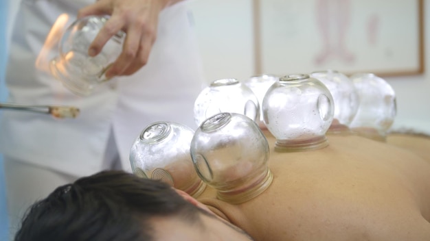 Alternative Asian Tibetan medicine, treatment using glass jars, jars placement, close-up