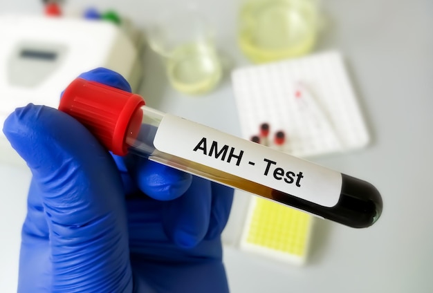 AMH  (anti-mullerian hormone) test, ovarian function and fertility test for women