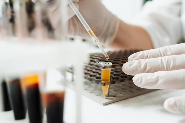 Analysis of blood plasma closeup Laboratory assistant hold test tube with blood from vein in his hands and looks at it Blood test in the laboratory