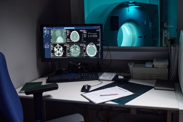 Analyzing Brain Scans in Medical Imaging Room
