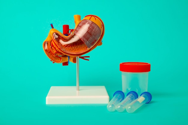 Anatomical model of human stomach with test tubes and jar for analysis on blue background Early diagnosis and treatment