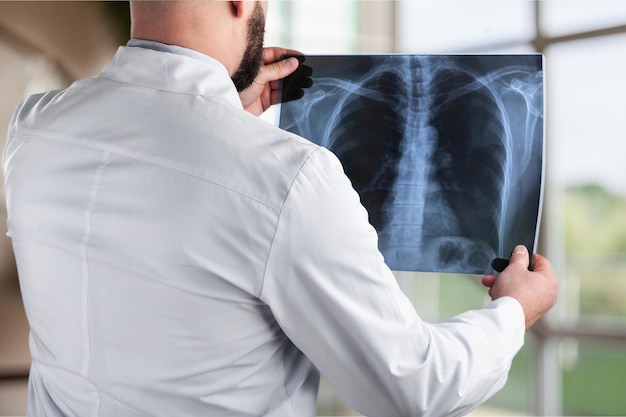 Anatomy background blur blurred body bone cardiomegaly