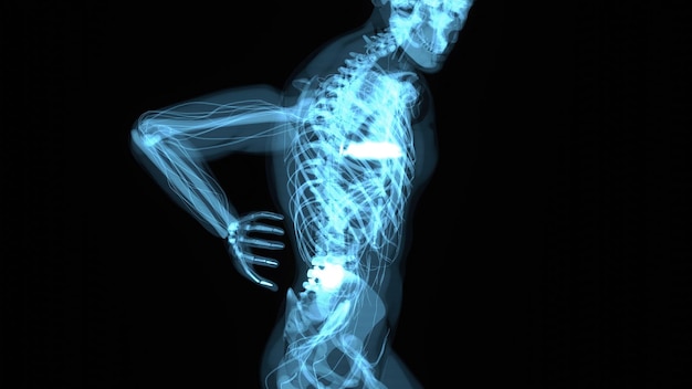 背中の痛みを抱える男性の解剖学的コンセプト x9