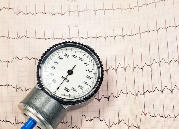 Photo aneroid sphygmomanometer lying on ecg diagram